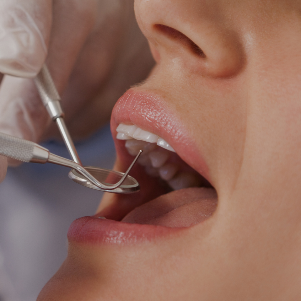 γενική οδοντιατρική Αργυρούπολη dental care